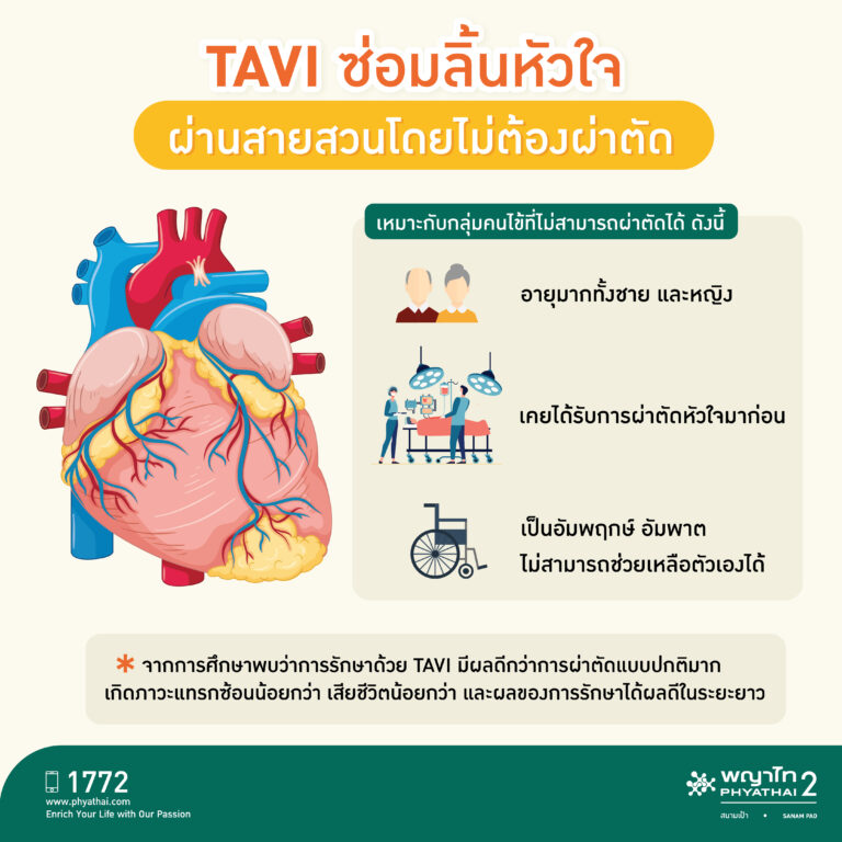 นวัตกรรมเพื่อผู้สูงอายุและผู้ป่วยโรคหัวใจ TAVI ซ่อมลิ้นหัวใจผ่านสายสวนโดยไม่ต้องผ่าตัด